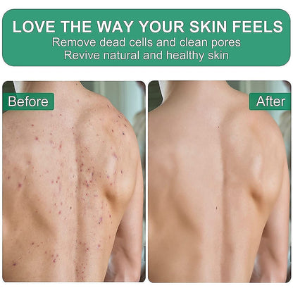 Gotleie Exfoliating Bath Gloves – Dead Skin Remover & Body Scrubber for Smooth, Youthful Skin